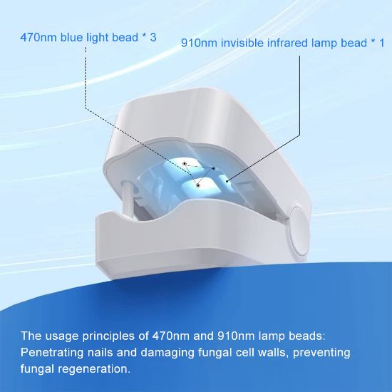 Imagen de Láser Para Hongos De Las Uñas. Antifúngico